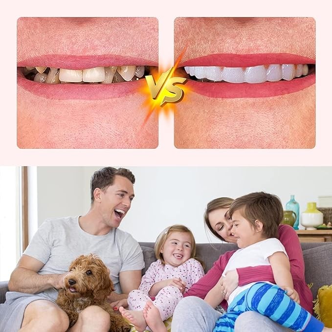 ake Teeth, 4PCS Temporary Fake Teeth for Women and Men, Nature and Comfortable 03